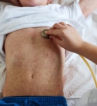 החצבת חוזרת: המחלה הנגיפית הקשה מתפשטת ברחבי העולם-תמונה